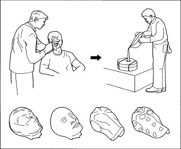 An example a mold being taken and the mask being formed.